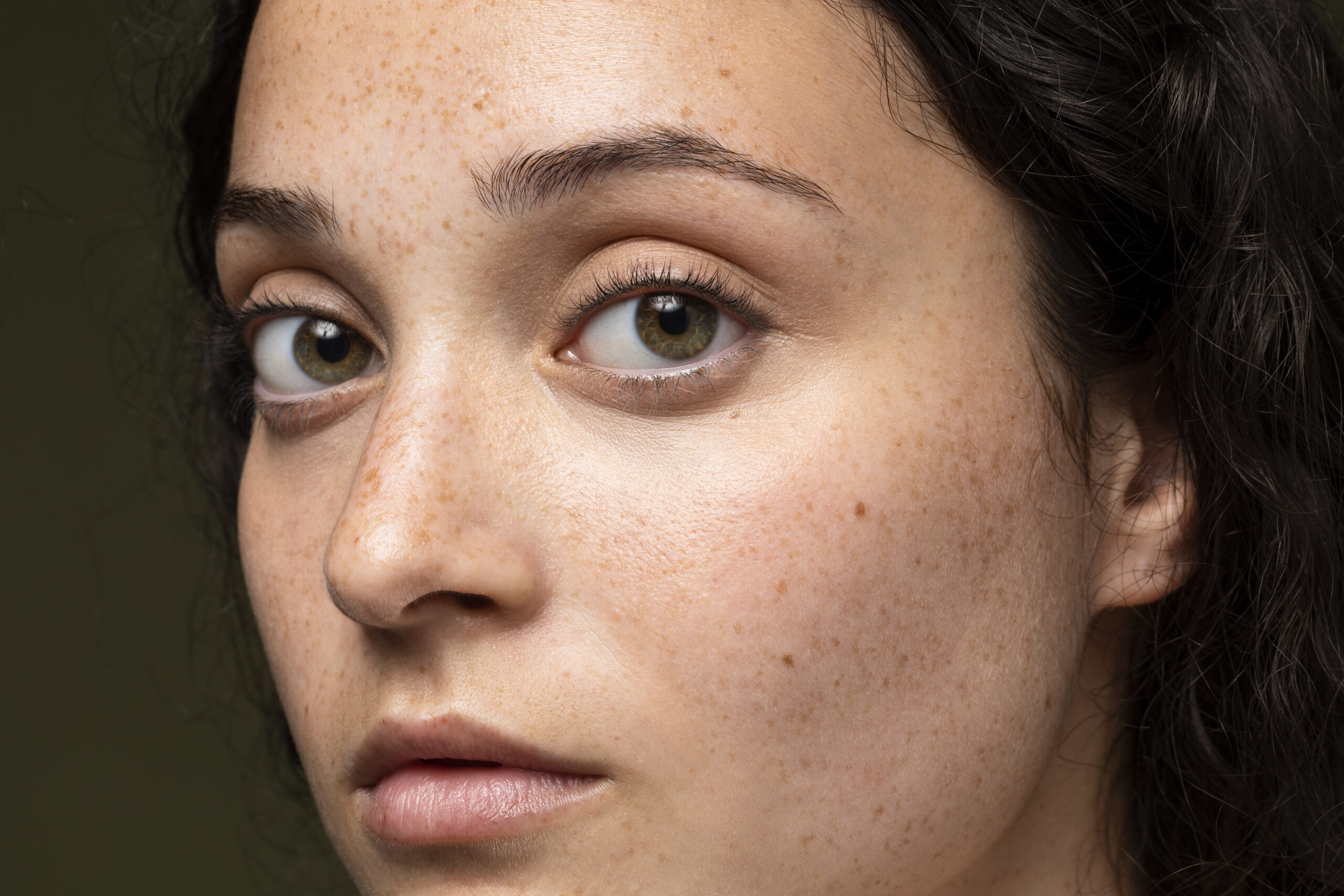 Which Are the Worst and Best Ways to Get Rid of Blackheads?